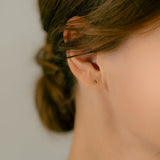 K10 Diamond Openheart